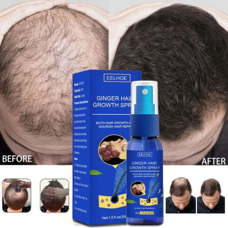 Epidermal Growth Factor - Ginger Hair Growth Serum Spray Anti