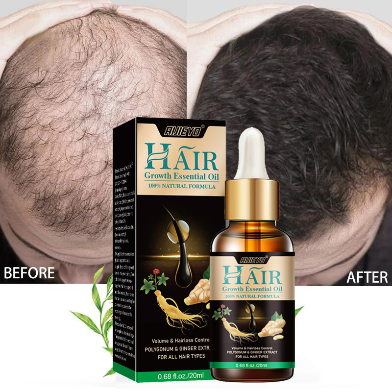 Epidermal Growth Factor - 2023 Biotin Fast Hair Growth Oil
