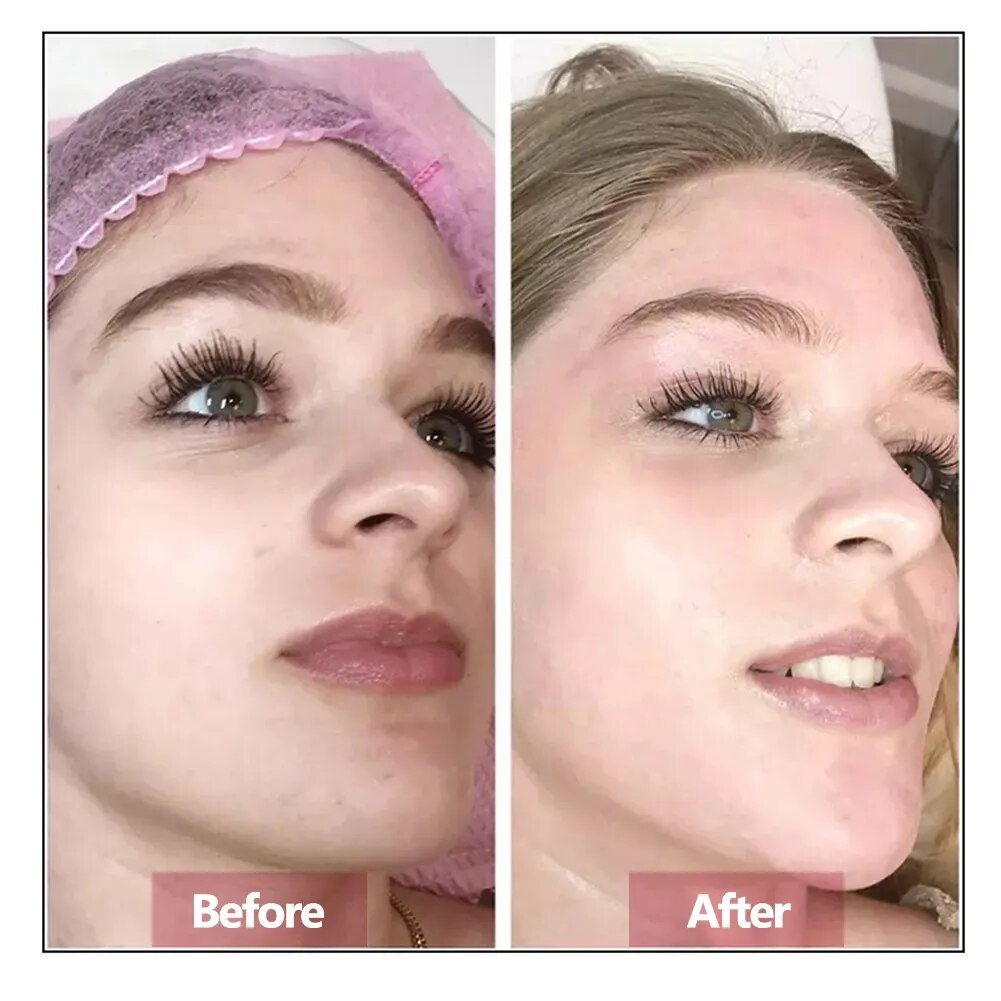Hyaluronic Acid Face Serum Ess - огляд і ціна Luxury Skincare Wholesale