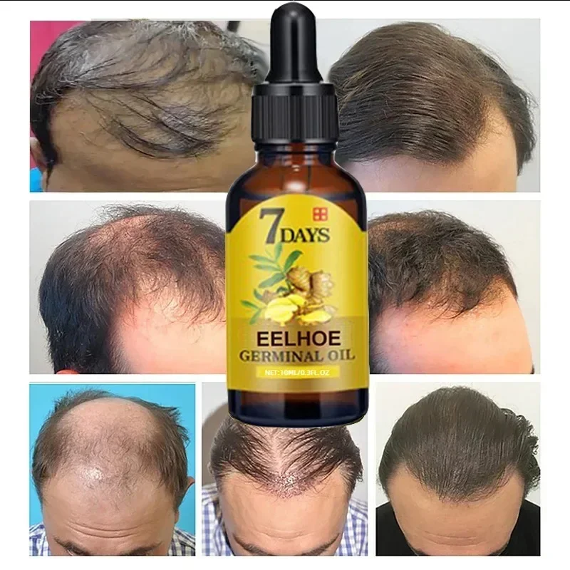 7 Day Fast Hair Growth Oil Gin - огляд і ціна Epidermal Growth Factor