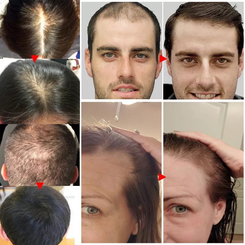 2023 Biotin Fast Hair Growth O - огляд і ціна Epidermal Growth Factor