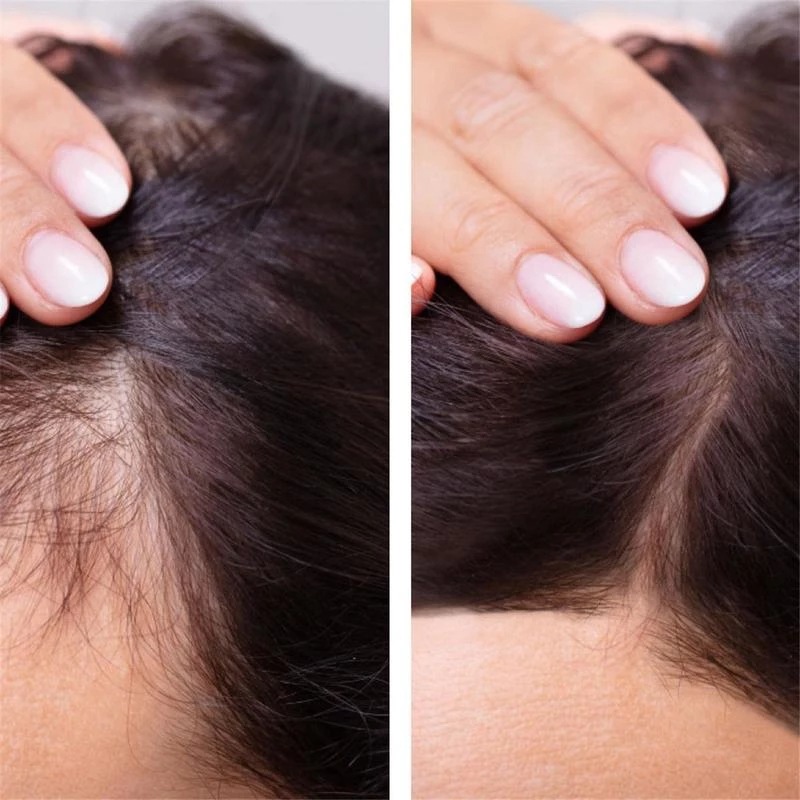 2023 Biotin Fast Hair Growth O - огляд і ціна Epidermal Growth Factor
