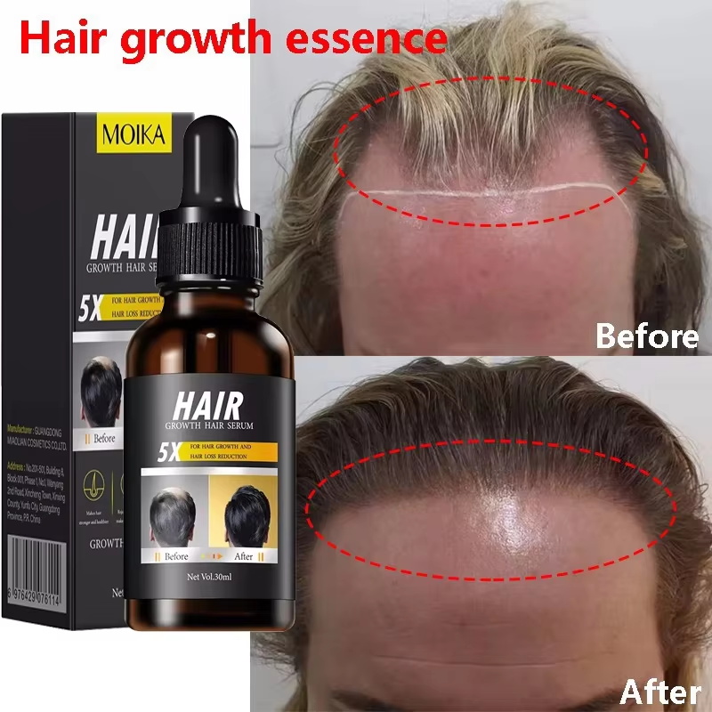 Fast Hair Growth Serum Hair Re - огляд і ціна Epidermal Growth Factor