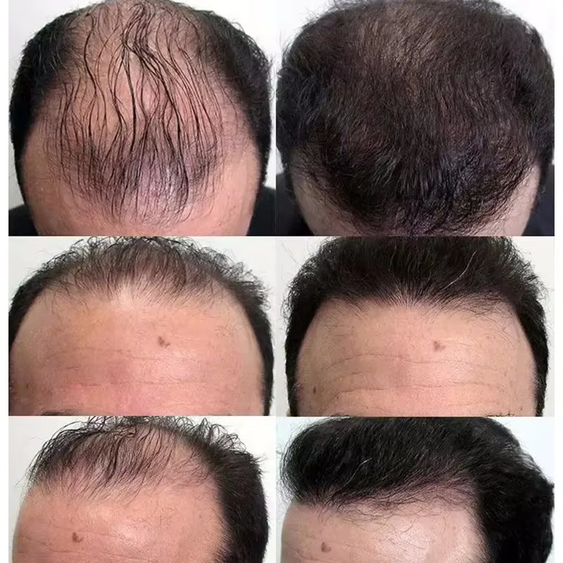Fast Hair Growth Serum Hair Re - огляд і ціна Epidermal Growth Factor