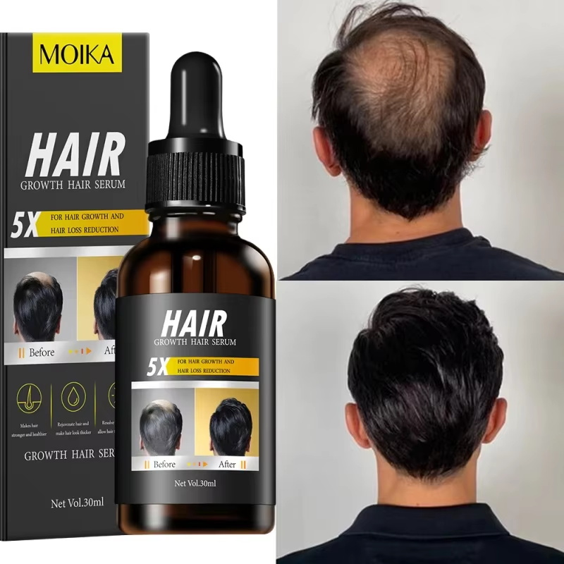 Fast Hair Growth Serum Hair Re - огляд і ціна Epidermal Growth Factor